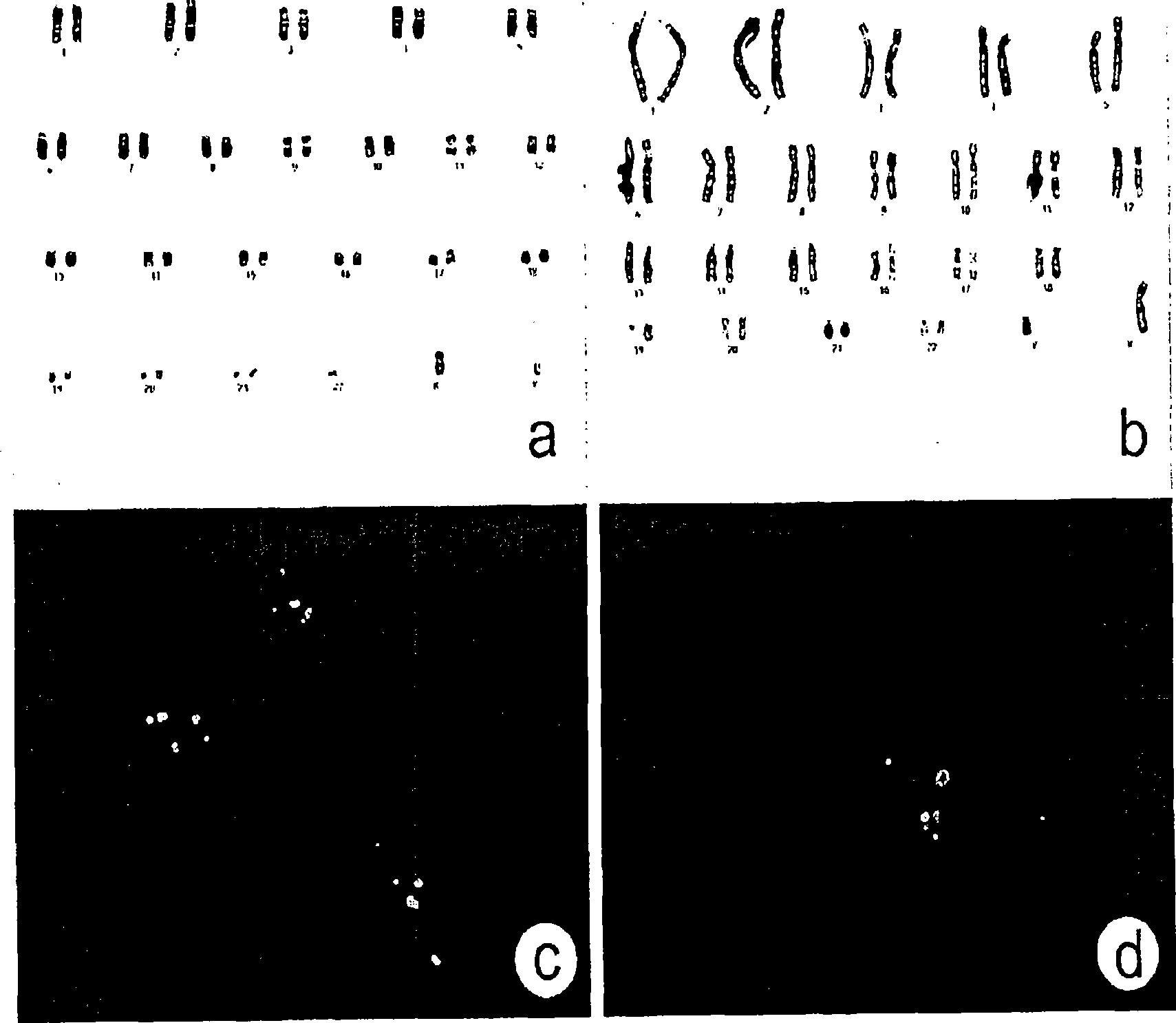 Culture system and method for propagation of human blastocyst-derived stem cells