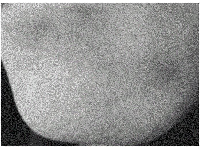 Scar-removing silica gel and preparation method thereof