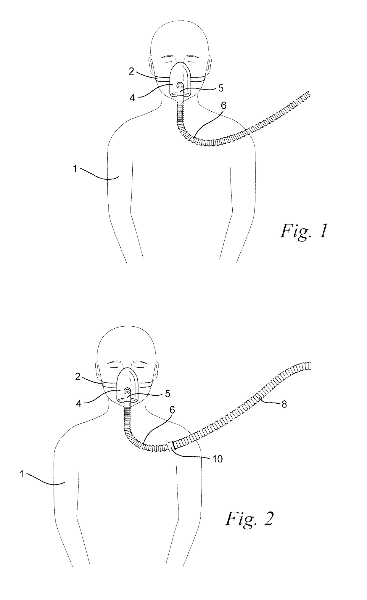 Retractable tube for CPAP