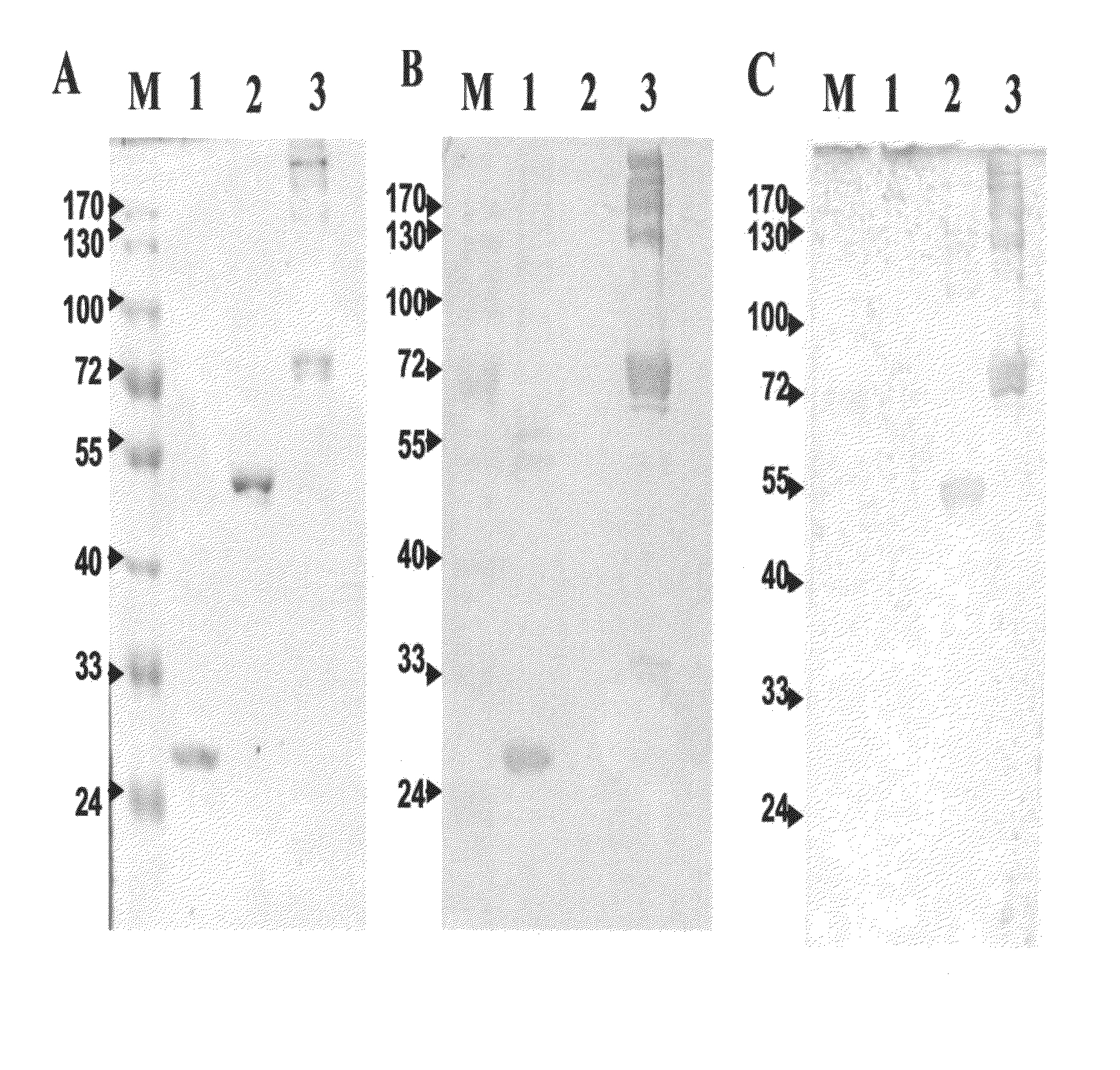 Anti-alpha-Enolase I Antibodies for Diagnosis and Treatment of alpha-Enolase I-Associated Diseases