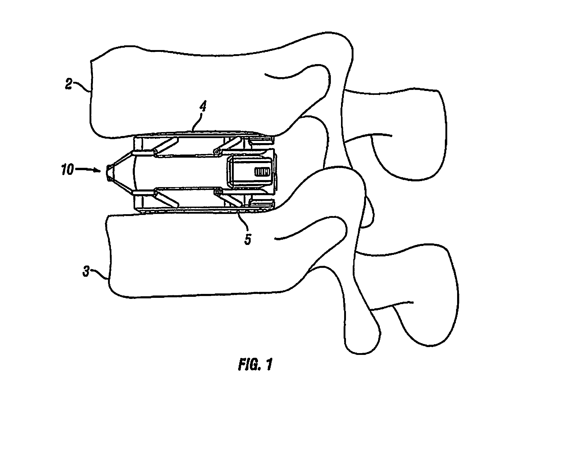 Expandable Fusion Device and Method of Installation Thereof