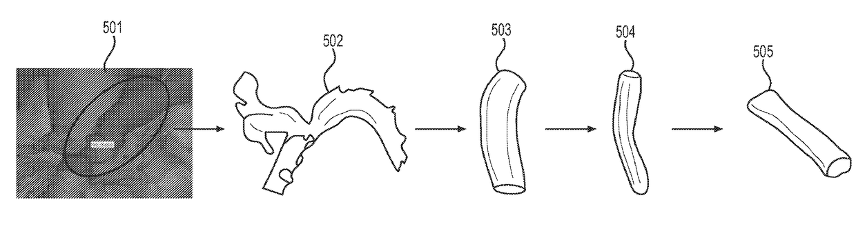 Patient-specific tissue engineered vascular graft utilizing electrospinning