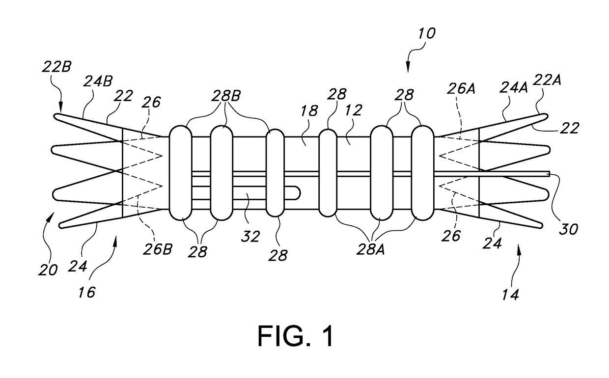 Advanced kink-resistant stent graft