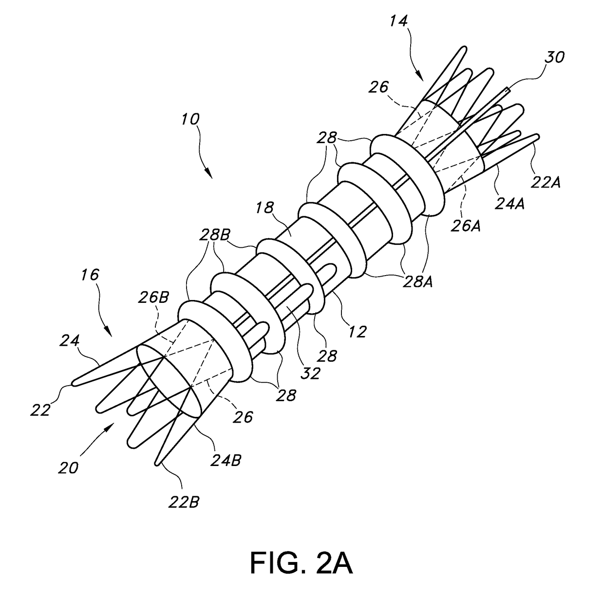 Advanced kink-resistant stent graft