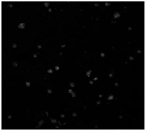 Immunofluorescent double staining kit for cervical cancer auxiliary diagnosis