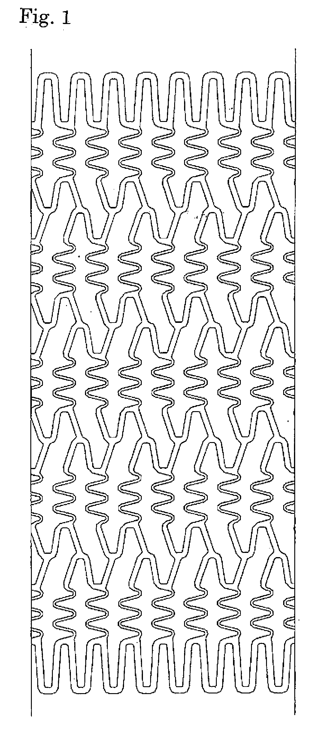 Stent for Placement in Body