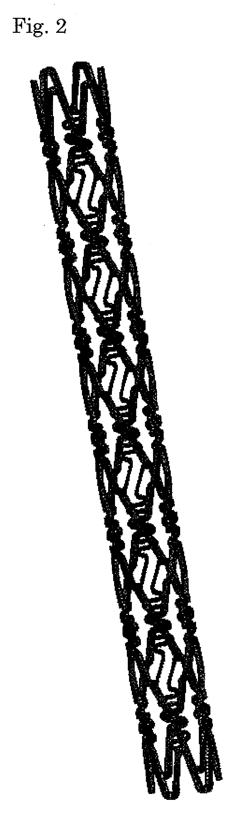 Stent for Placement in Body