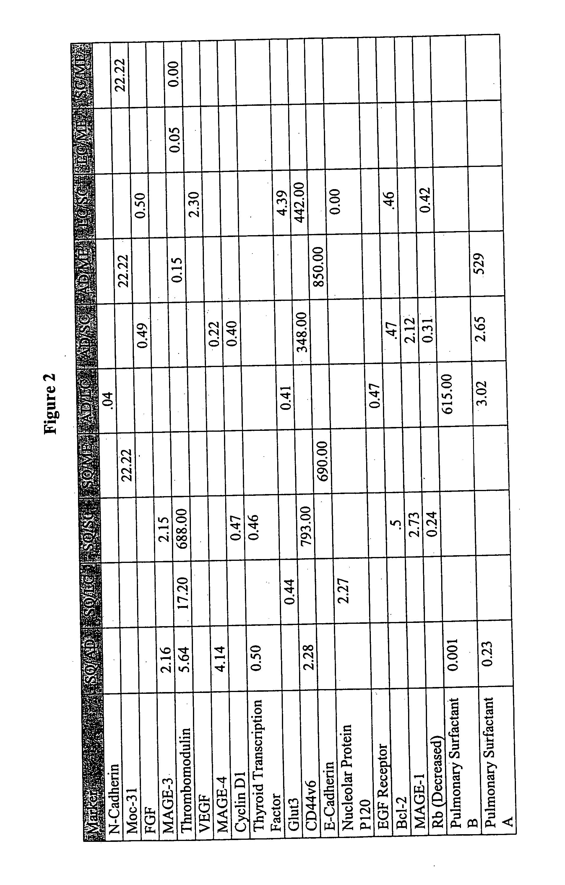 Cell-based detection and differentiation of lung cancer