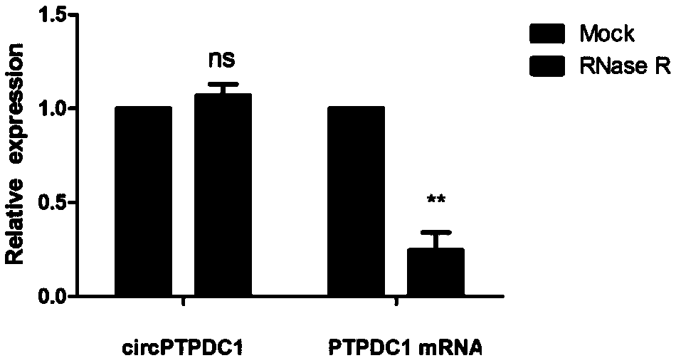 Application of novel gastric cancer marker gene circPTPDC1