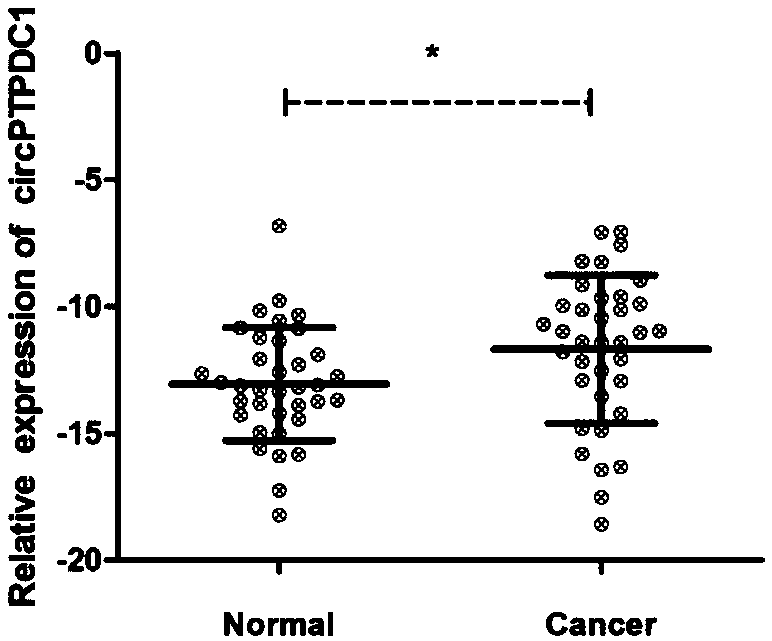 Application of novel gastric cancer marker gene circPTPDC1