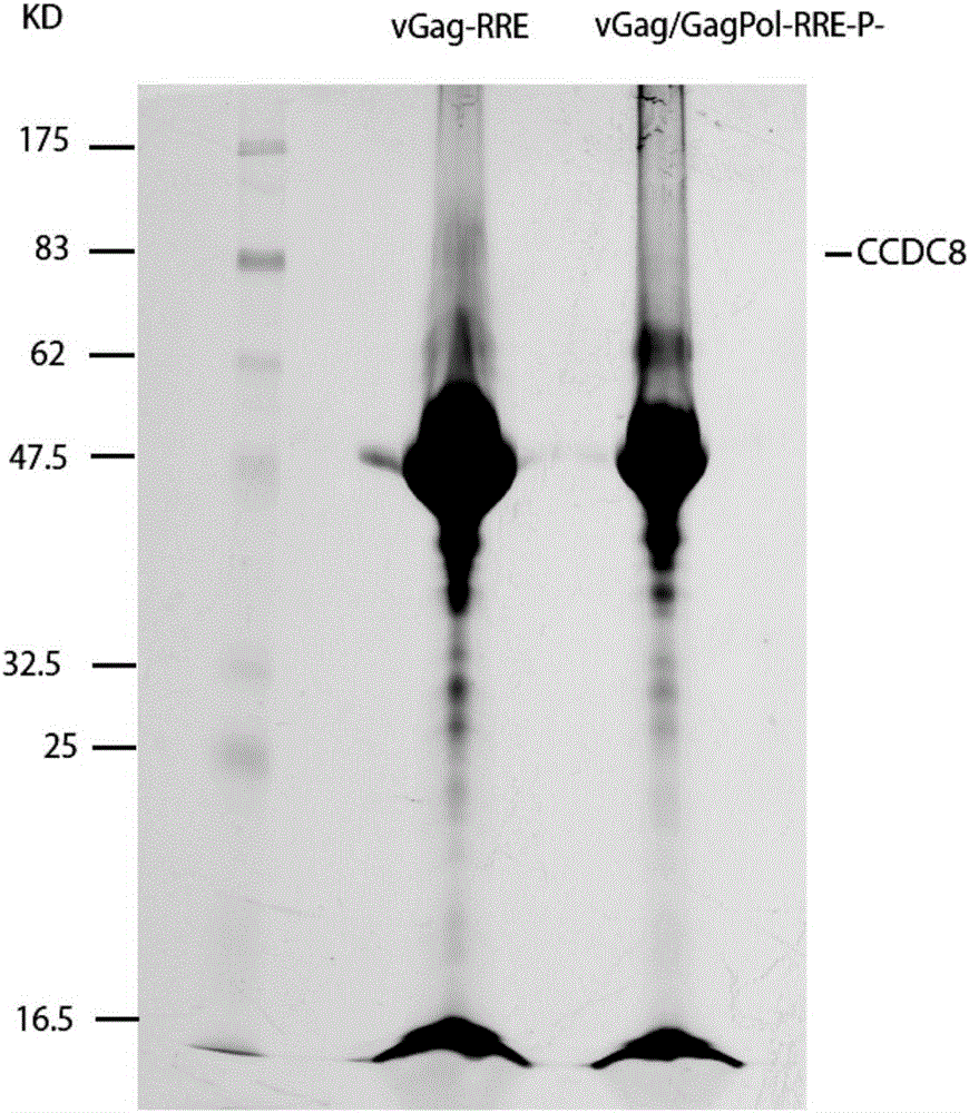 Coiled-coil domain containing protein 8 (CCDC8) having inhibition on HIV-1 and application thereof