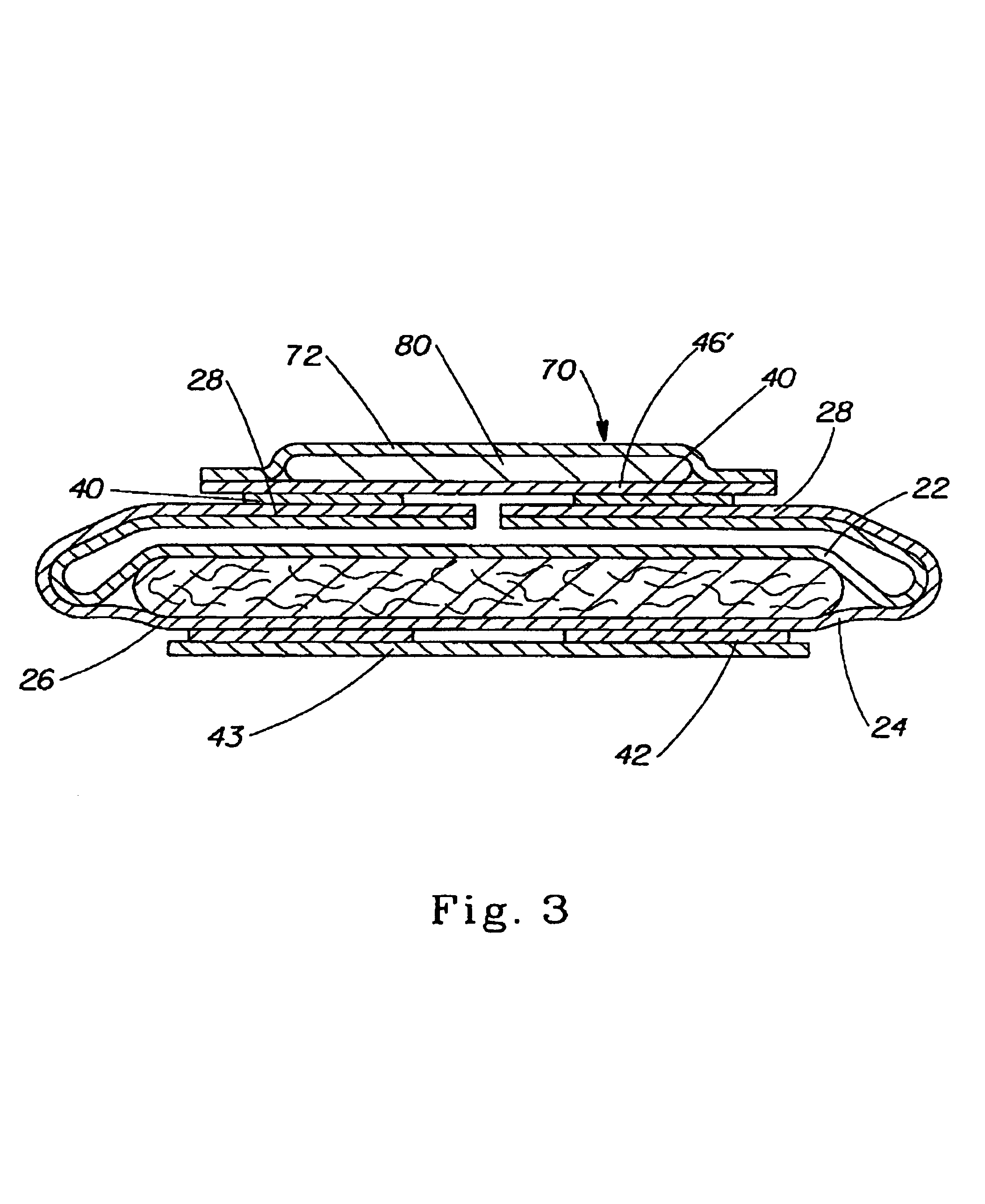 Sanitary napkin having a wipe article associated therewith