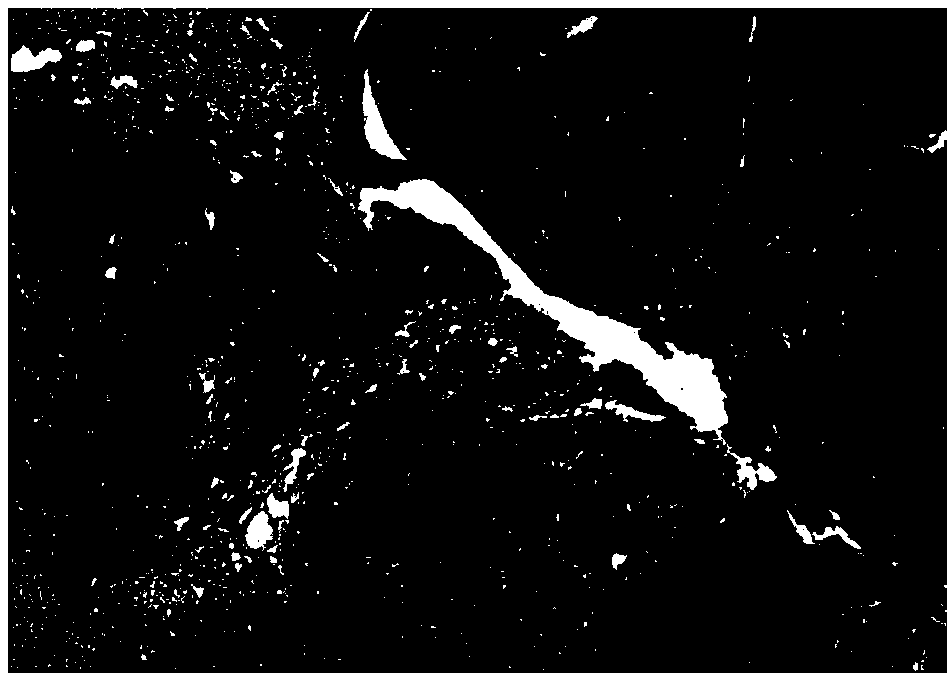 Automatic analysis method of ki67 index