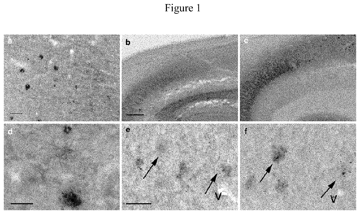 Identification of granins as the pathogenic factor of alzheimer's disease and compositions and methods for inhibiting granin aggregation and treating alzheimer's disease