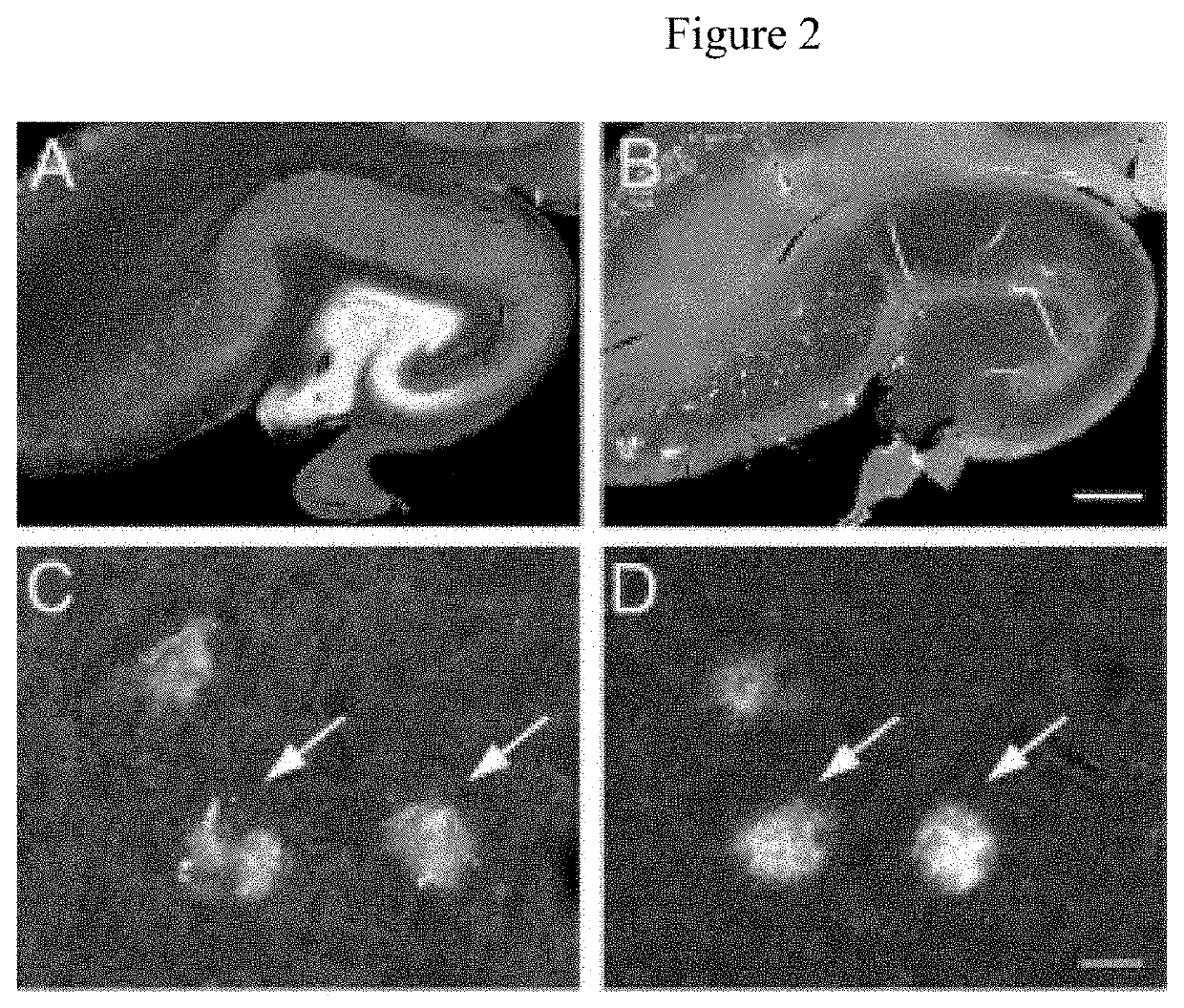 Identification of granins as the pathogenic factor of alzheimer's disease and compositions and methods for inhibiting granin aggregation and treating alzheimer's disease