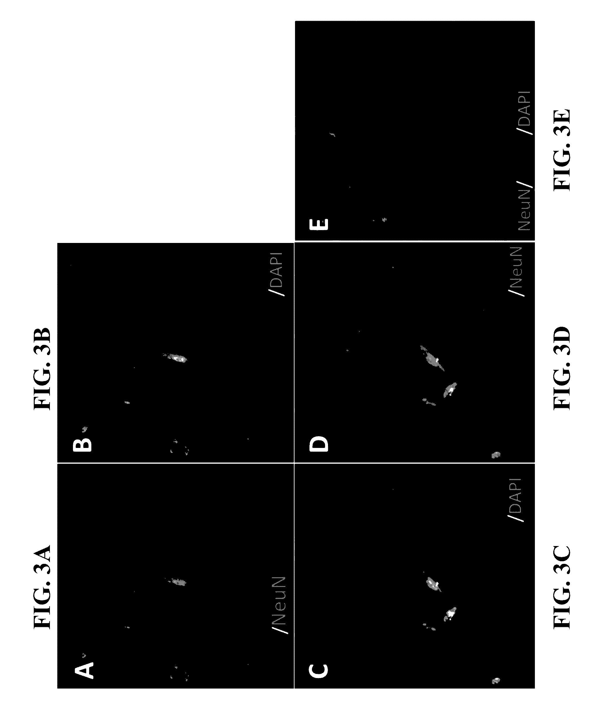 Conversion of non-neuronal cells into neurons