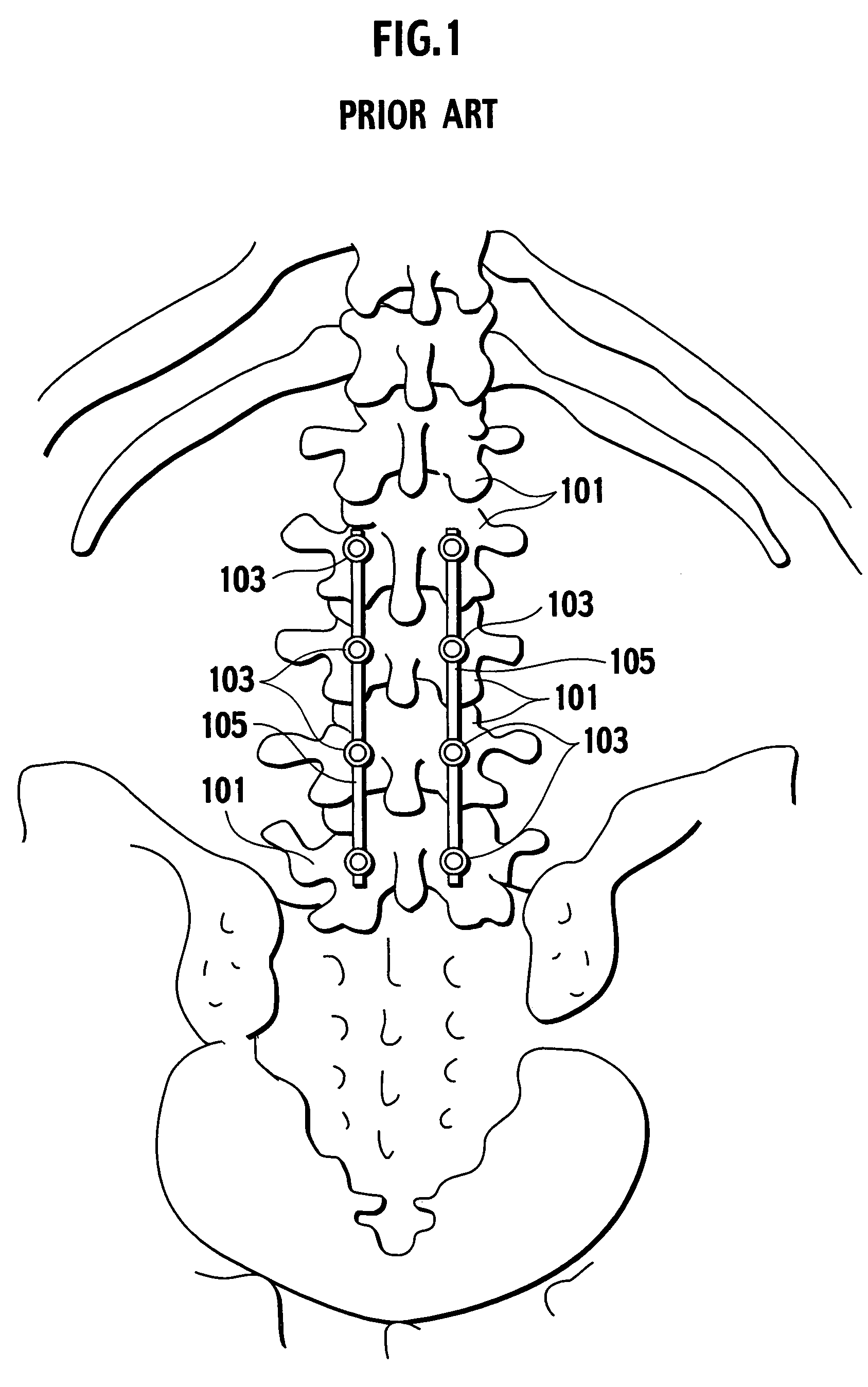 Auxiliary instrument for fixing rod