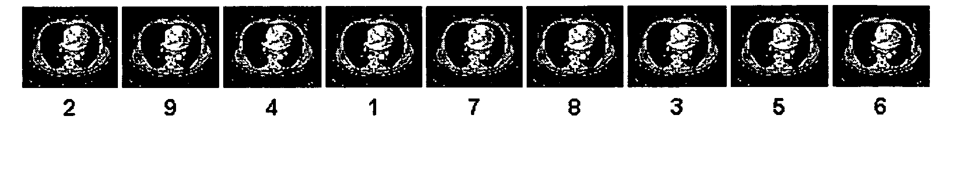 System and method for displaying images on a pacs workstation based on level of significance