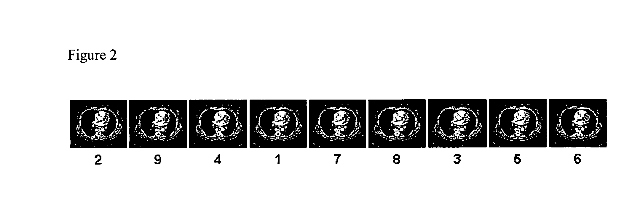 System and method for displaying images on a pacs workstation based on level of significance