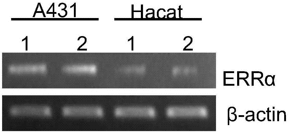 Application of estrogen-related receptor alpha as diagnostic marker for cutaneous squamous cell careinoma and related application of application