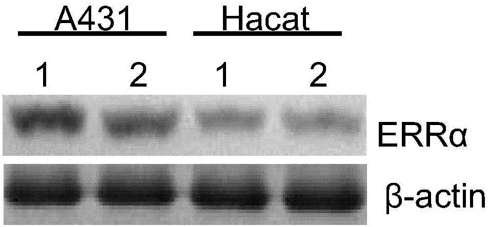 Application of estrogen-related receptor alpha as diagnostic marker for cutaneous squamous cell careinoma and related application of application