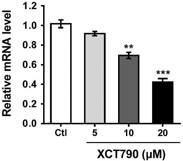 Application of estrogen-related receptor alpha as diagnostic marker for cutaneous squamous cell careinoma and related application of application