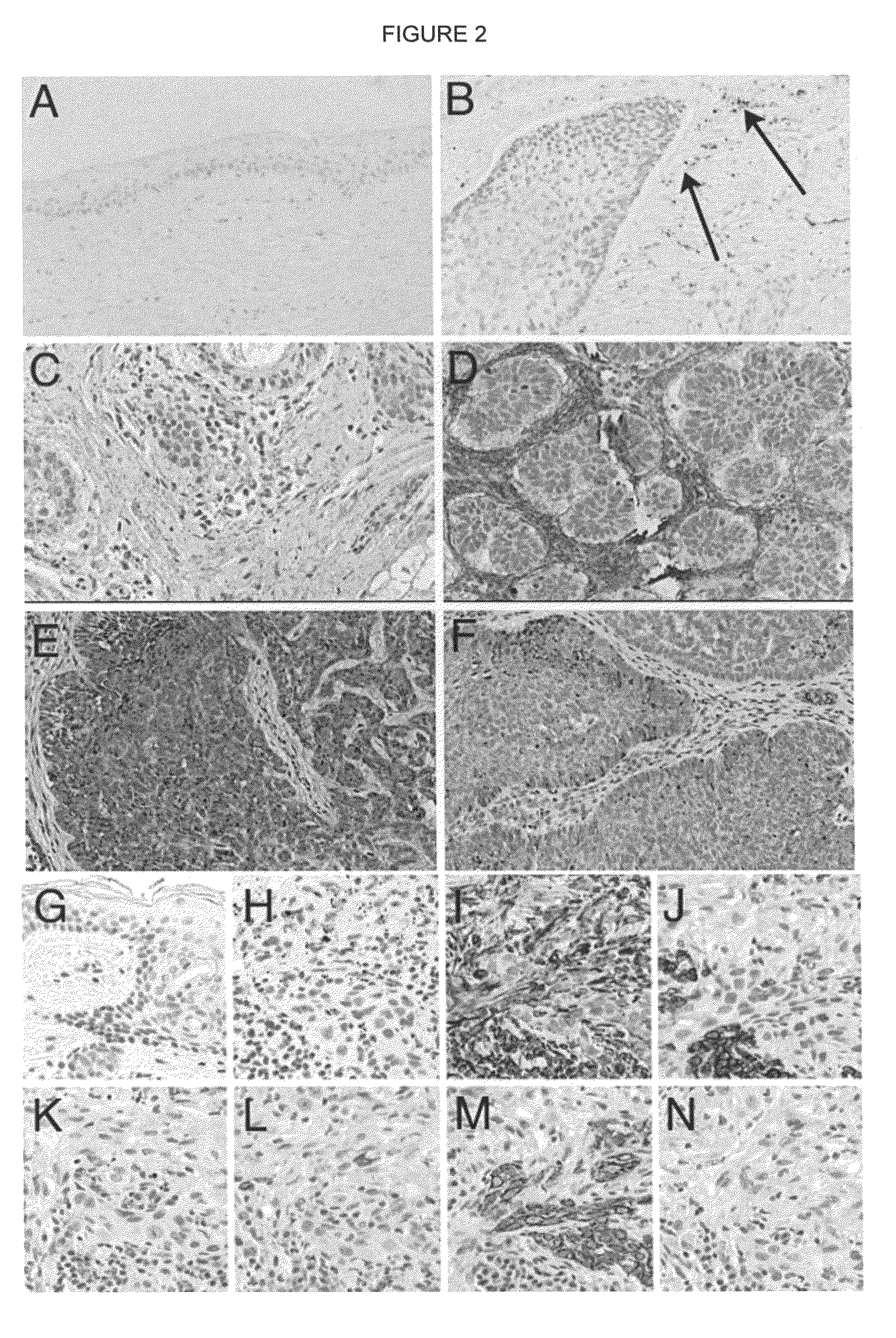 Bone morphogenetic protein antagonist and uses thereof