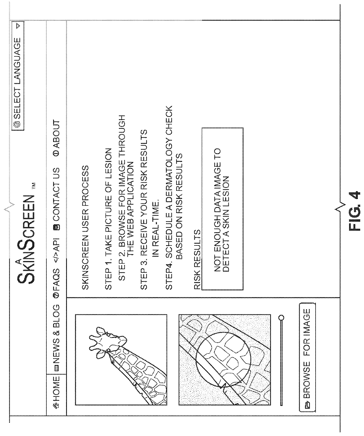 System, method, apparatus and computer program product for the detection and classification of different types of skin lesions