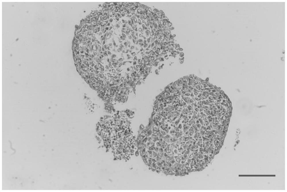 Culture medium for culturing primary cells of solid tumors of bone and soft tissue tumors