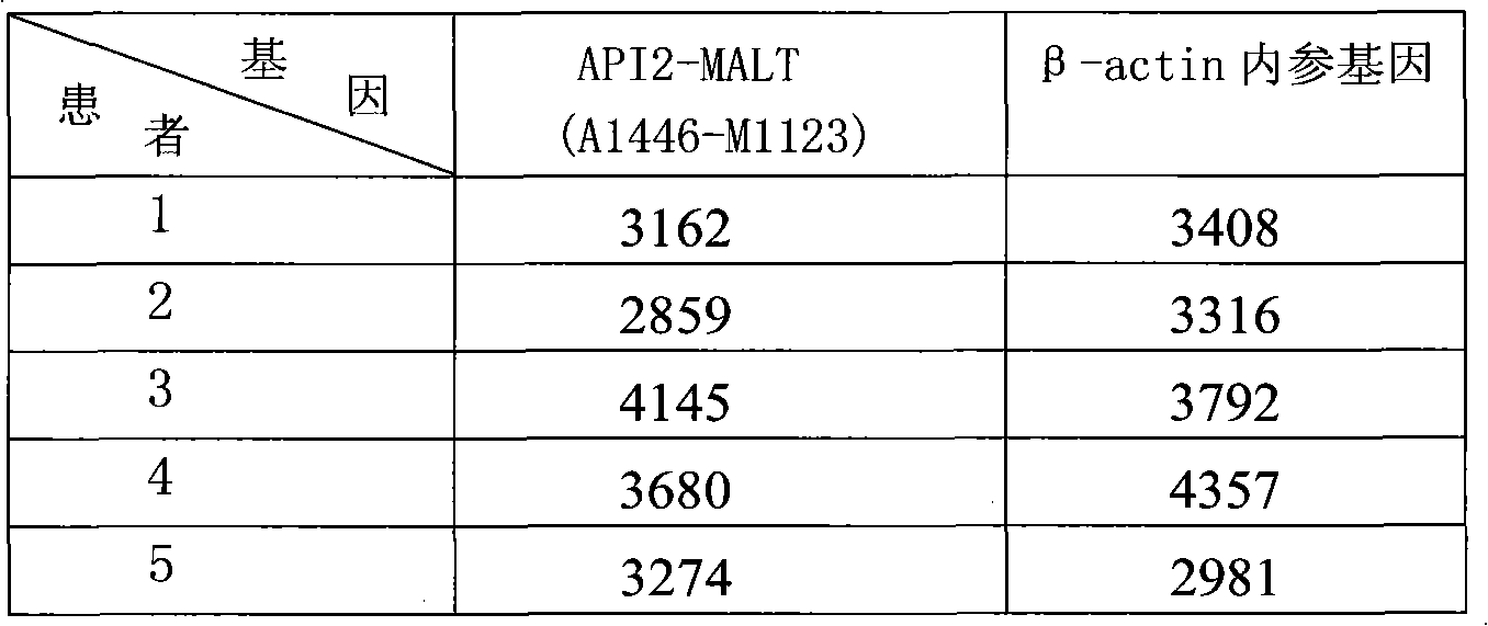 Combined detection method and diagnostic kit of fusion genes related to lymphoma