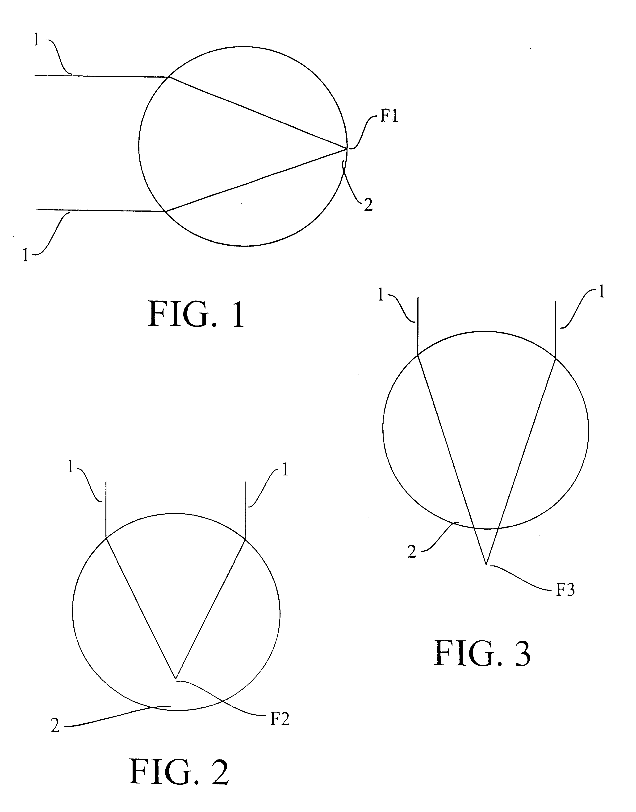 Method and apparatus to correct refractive errors using adjustable corneal arcuate segments