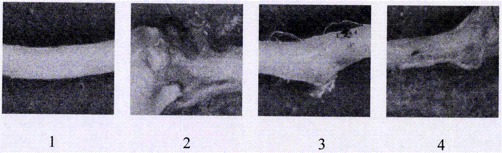 Medicinal composition for treating atherosclerosis and application