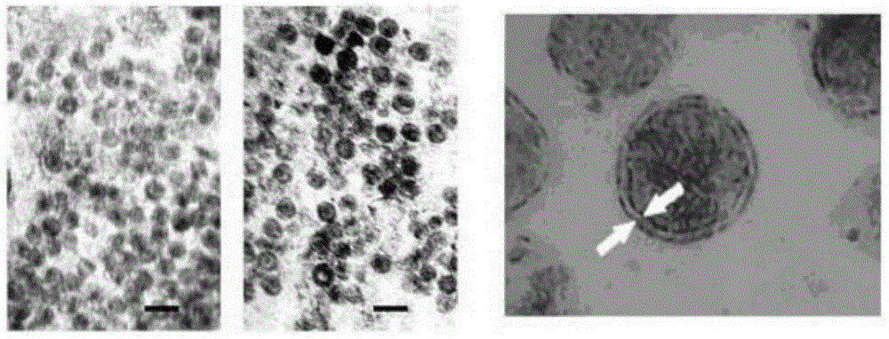 High-quality exosome and preparation method thereof