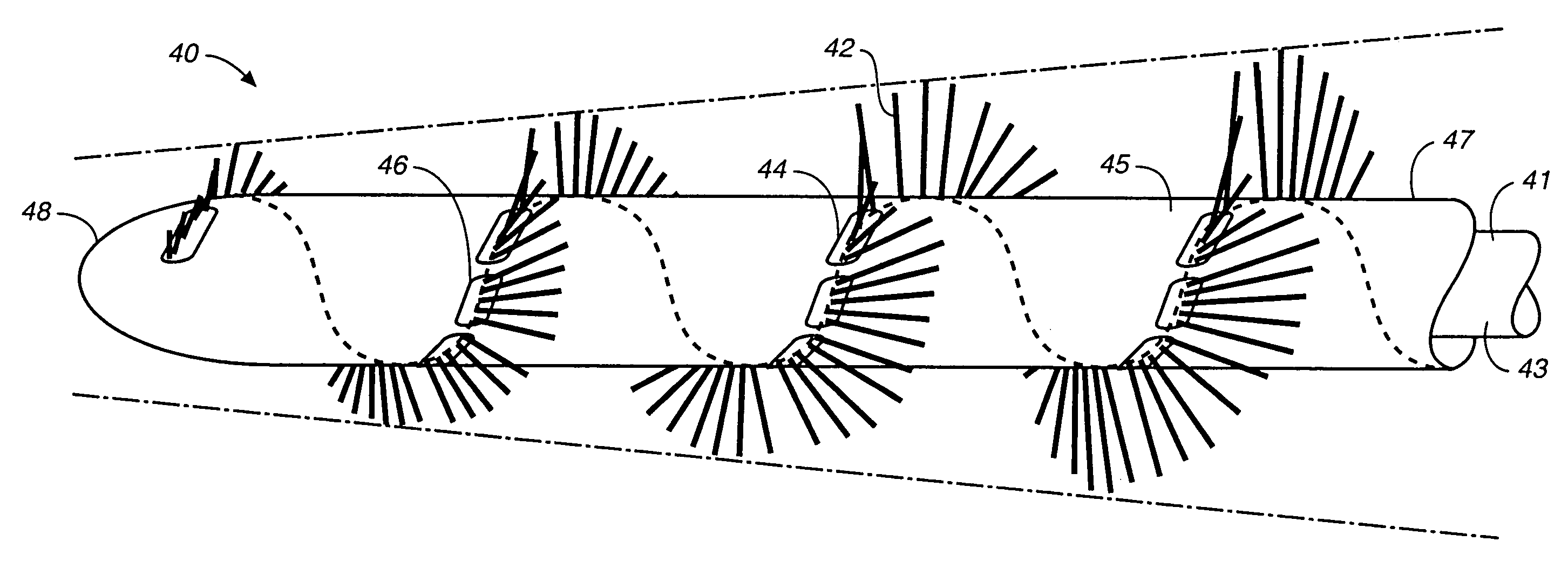 Intravascular material removal device