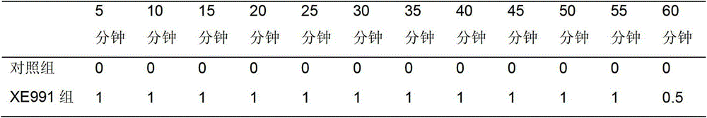 Method for analyzing Parkinson disease therapeutic effect