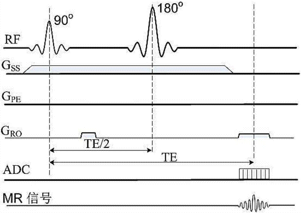 SAR value determination method of magnetic resonance imaging and magnetic resonance imaging device