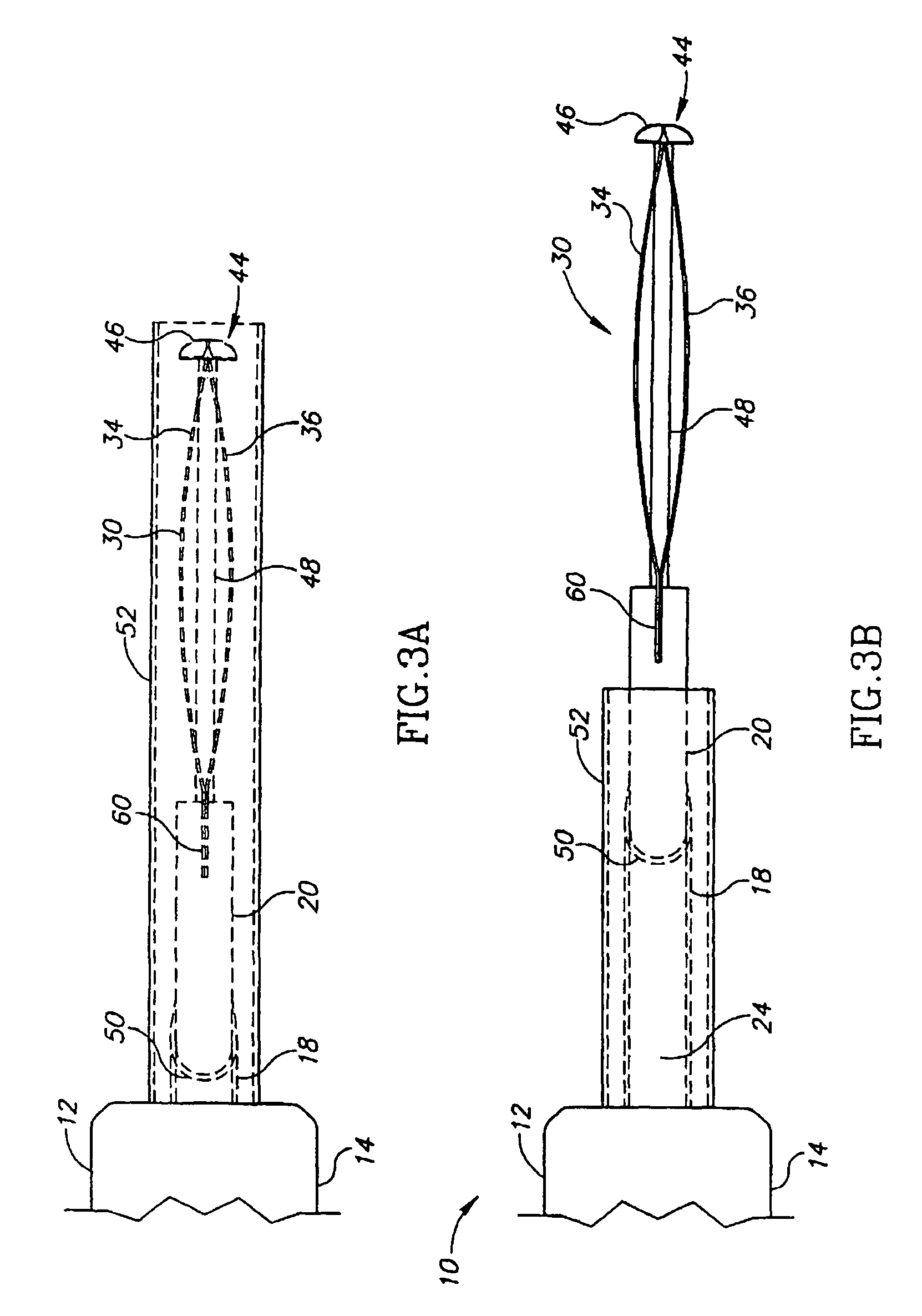 Thermal capsulotomy tool and system