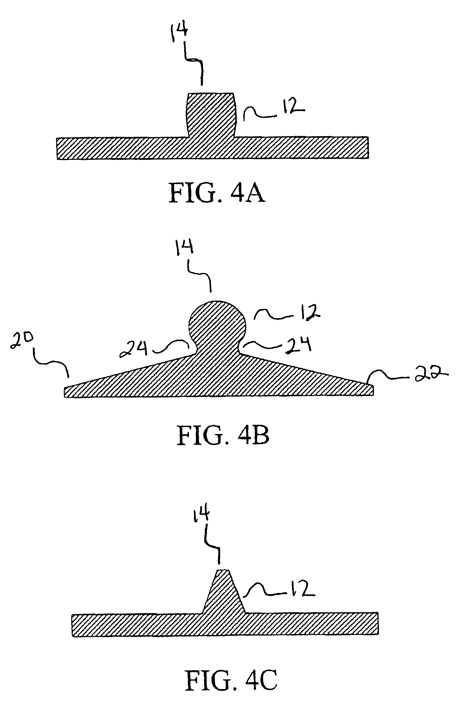 Spinal disc annulus reconstruction method and deformable spinal disc annulus stent