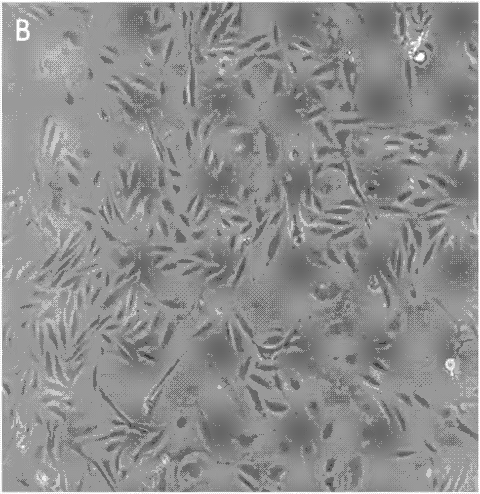 Human anaplastic thyroid carcinoma cell line and application thereof