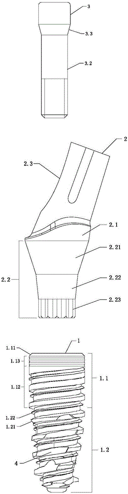 Ceramic rotation-resistant angle base station implant system