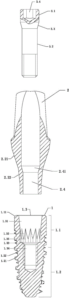 Ceramic rotation-resistant angle base station implant system