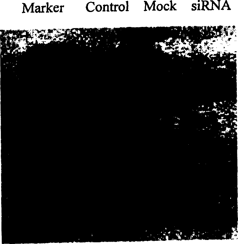 SiRNA and expression plasmid for inhibiting human bc1-2 gene expression and their use for preparing medicine