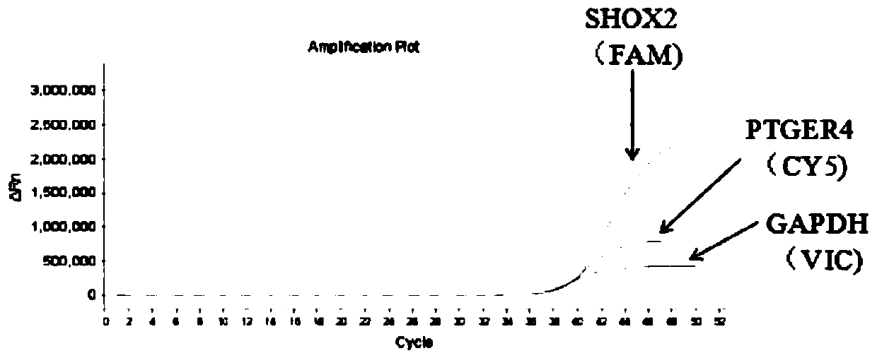 A composition for non-invasive screening of early lung cancer and its application