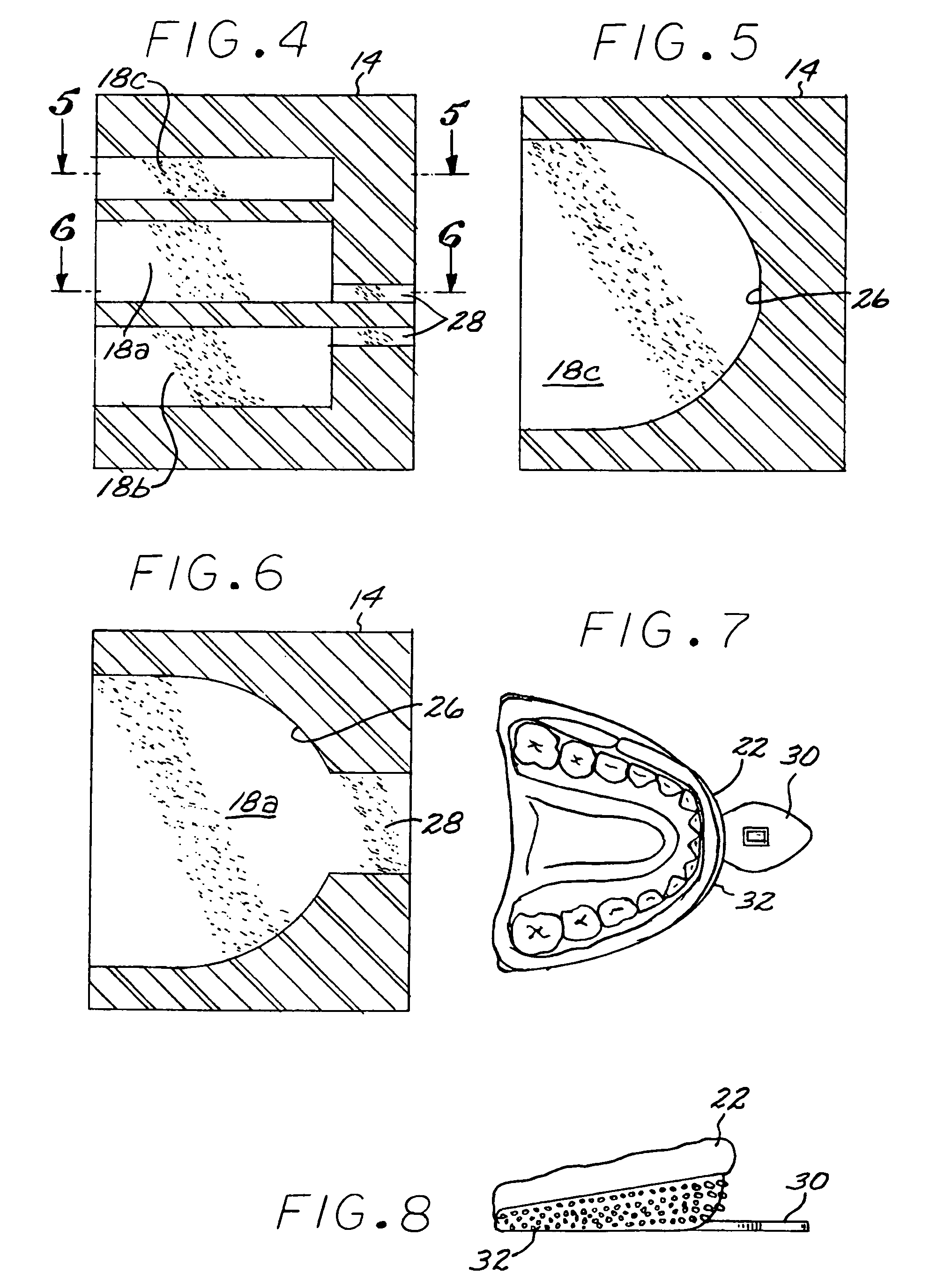 Container for transporting and processing three-dimensional dentition models