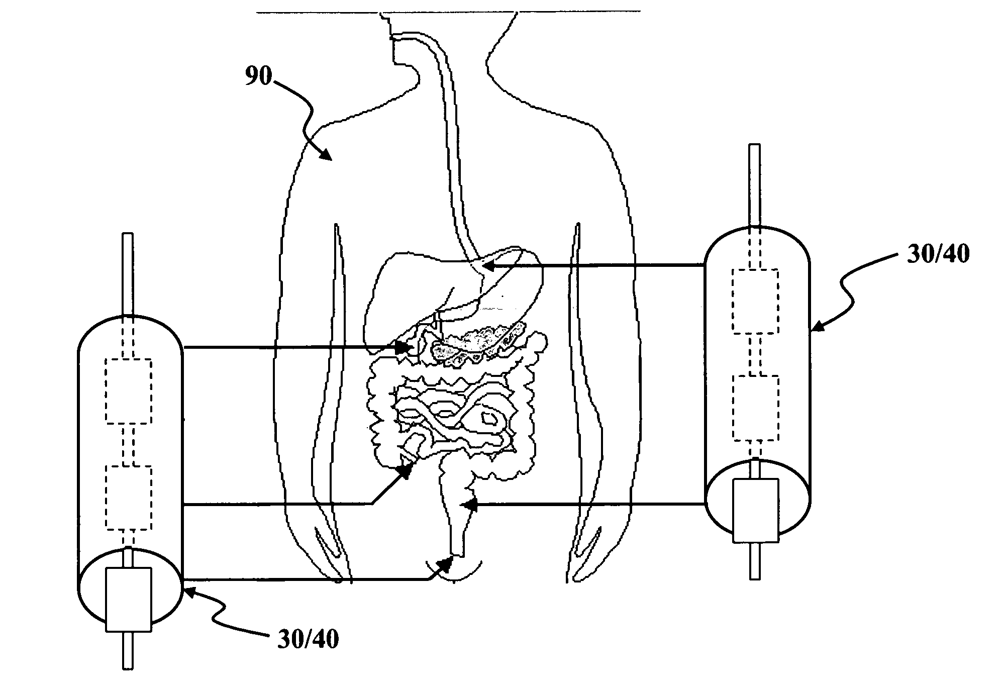 Linear electromechanical device-based artificial muscles, bio-valves and related applications