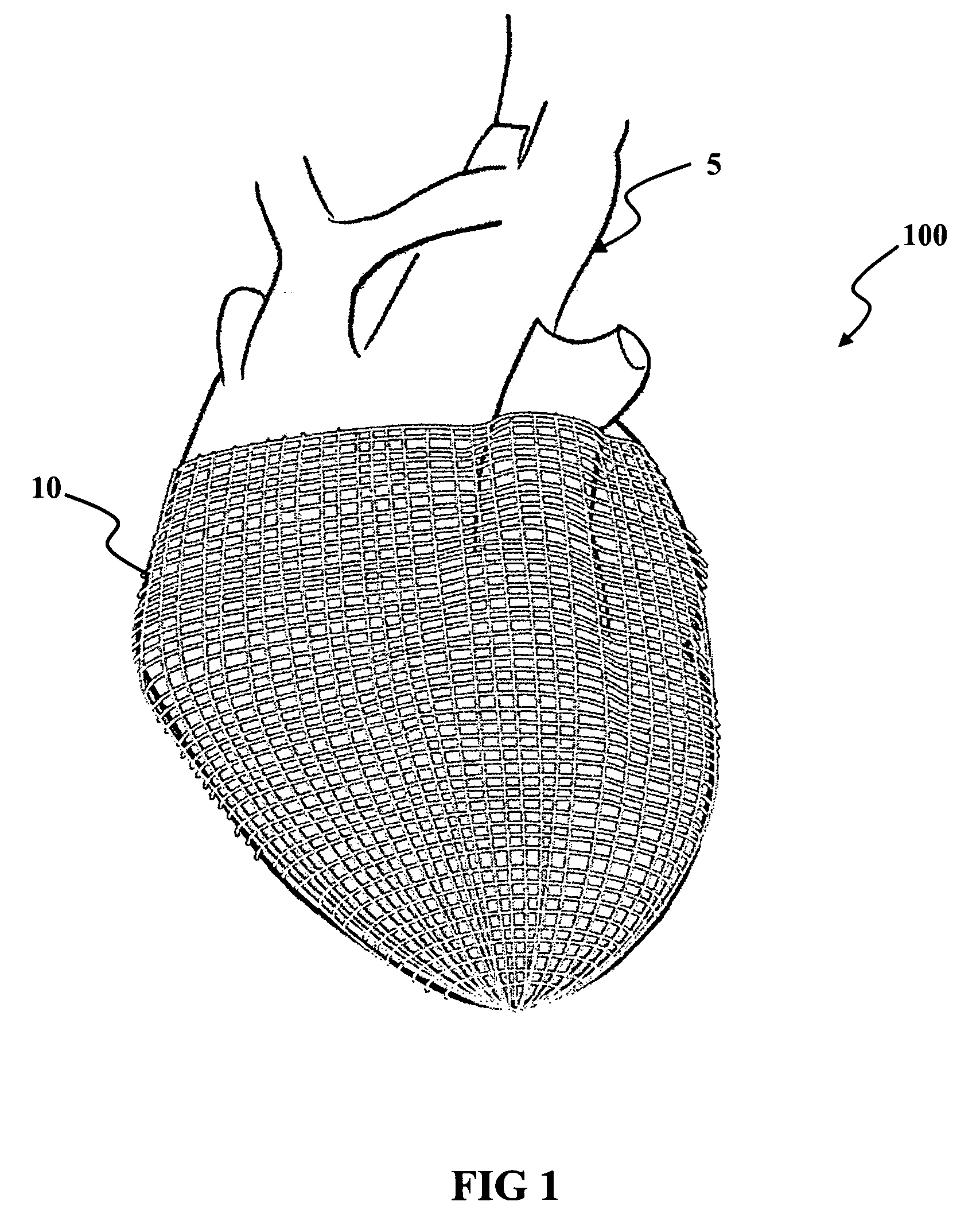 Linear electromechanical device-based artificial muscles, bio-valves and related applications