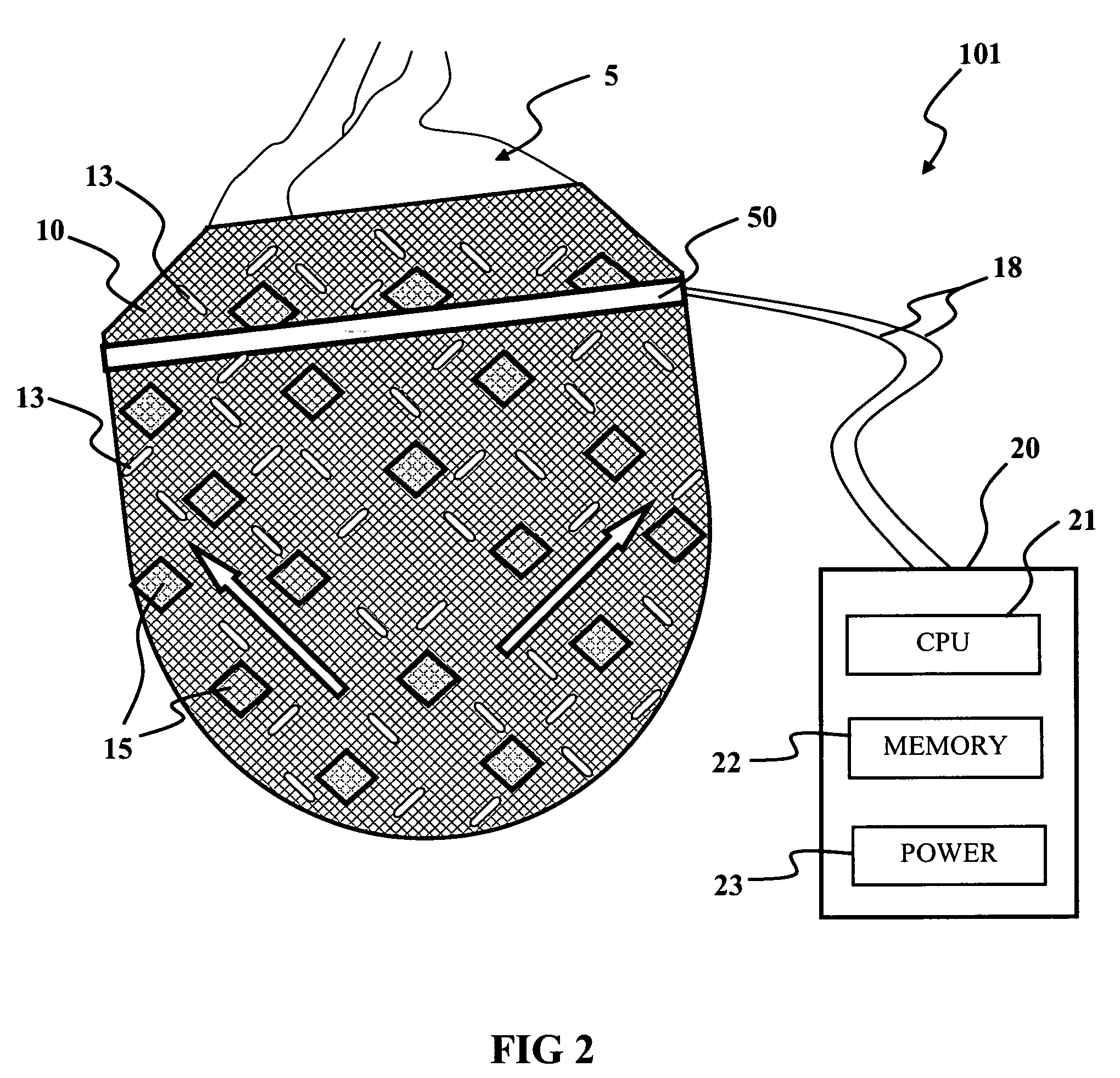 Linear electromechanical device-based artificial muscles, bio-valves and related applications