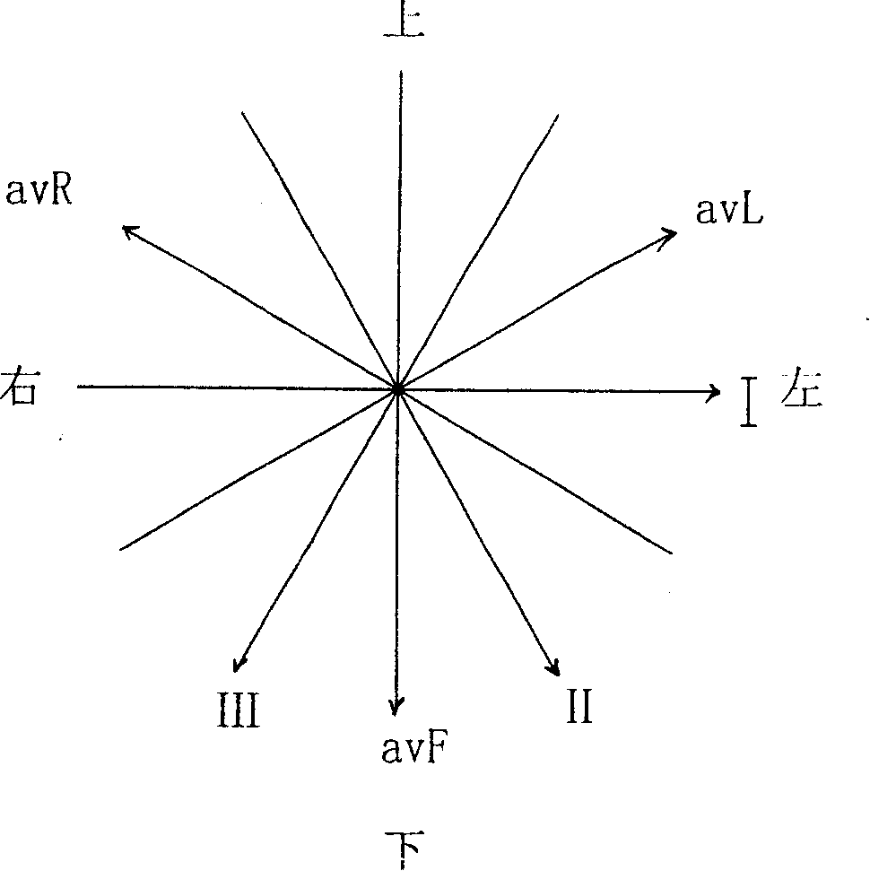 Method for changing multiple synchronous electrocardiogram lead in corrected orthogonal electrocardiogram mode