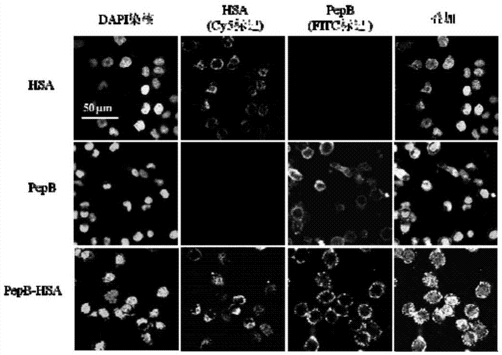 Polypeptide-albumin coupling drug and preparing method and application thereof