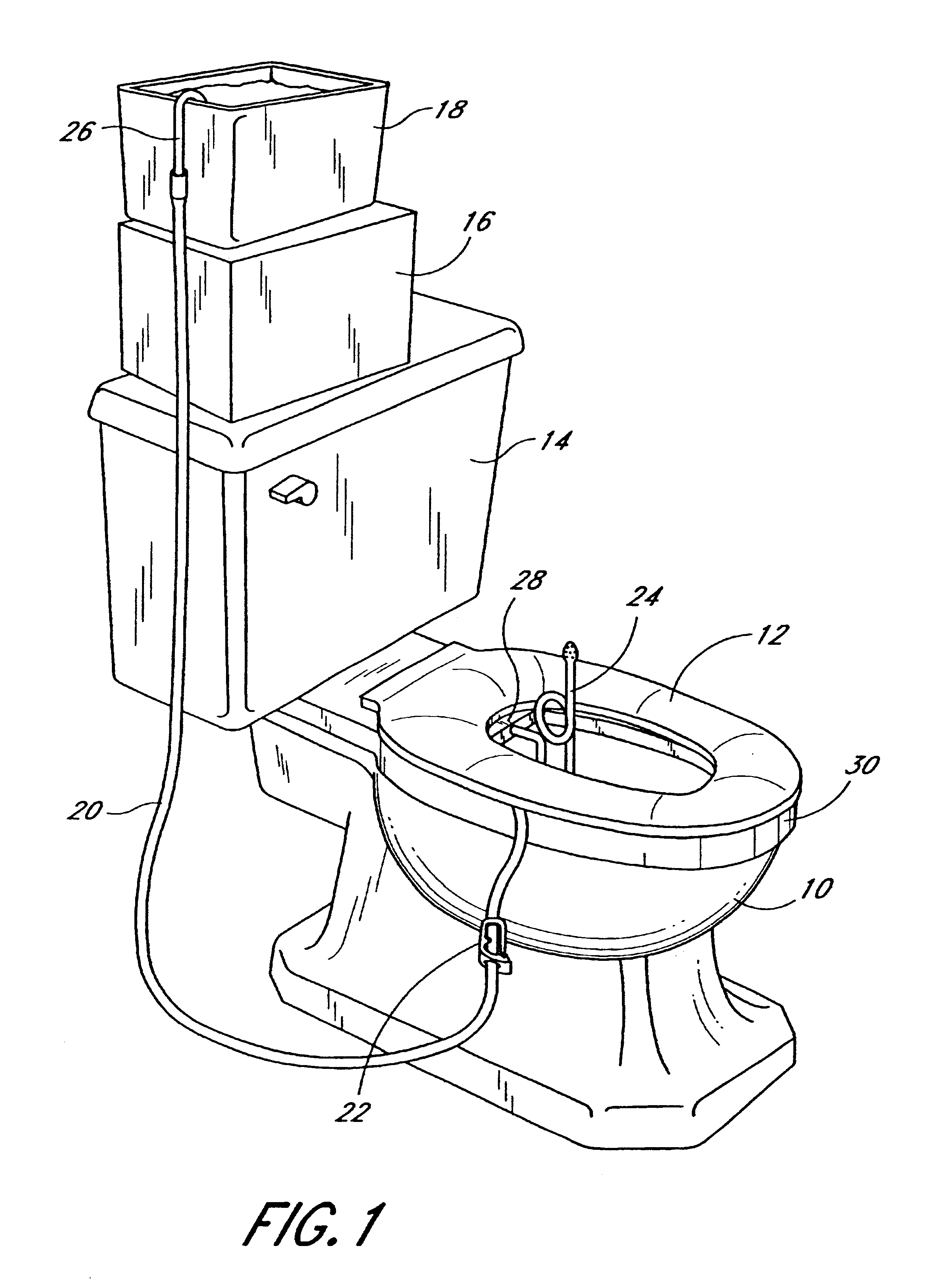 Hygienic, removable toilet attachment for enema, douche or colonic irrigation